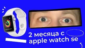 Обзор Apple Watch SE. Стоит ли покупать? Личный опыт. 10 супер-полезных функций. Минусы Apple Watch.